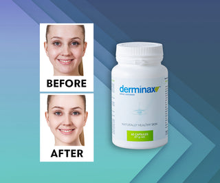 Таблетки против акне, пъпки и несъвършенства с цинк, витамин C, E и B2 Derminax - 2