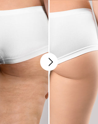 Таблетки против целулит и цялостно подобряване на състоянието на кожата с естествени екстракти Cellinea 60 капсули_3 - 3