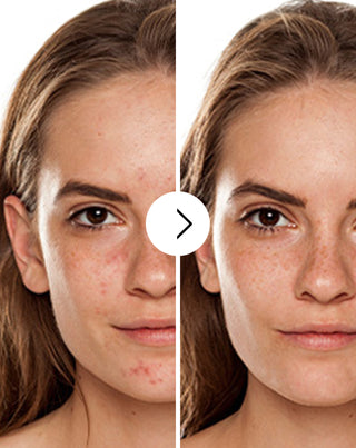 Таблетки против акне, пъпки и несъвършенства с цинк, витамин C, E и B2 Derminax_2 - 2