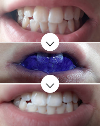 White Bite Smilebite серум за избелване на зъбите 30 ml - 3