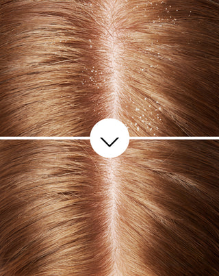 Шампоан за коса против пърхот с пироктон оламин с хидратиращ ефект Nutridome - 5