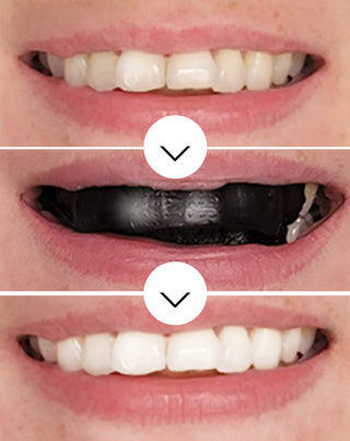 The White(ning) Stripes Комплект от 28 ленти за избелване на зъби Smilebite. - 3