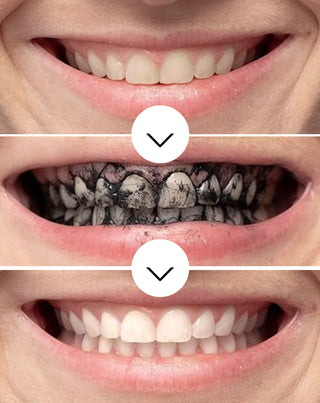 Избелваща пудра за зъби с кокосов въглен Smilebite